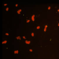 Negative IFA for antibodies to T. gondii