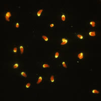 Negative IFA for antibodies to T. gondii, polar stain reaction