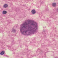 Toxoplasma gondii cyst, hematoxylin and eosin stain