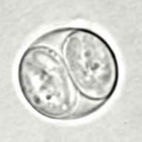 T. gondii sporulated oocyst, unstained