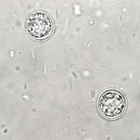 T. gondii unsporulated oocyst, unstained