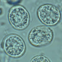 T. gondii oocysts in a fecal floatation