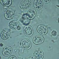 T. gondii oocysts in a fecal floatation