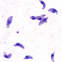 Toxoplasma gondii tachyzoites, Giemsa stain