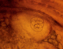 Trichinella encysted larva