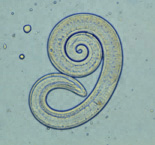 Trichinella larva