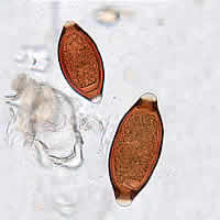 T. trichiura eggs