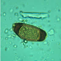Atypical Trichuris egg