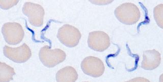 T. b. rhodesiense, Giemsa stain