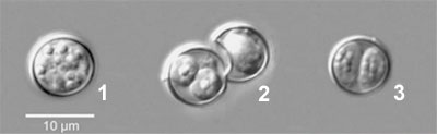 Cyclospora oocysts