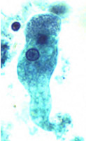 E. histolytica/dispar trophozoite