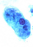 E. histolytica/dispar trophozoite