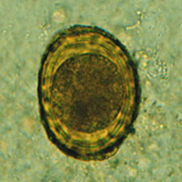 A. lumbricoides fertilized egg