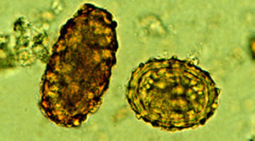 A. lumbricoides fertilized and unfertilized eggs