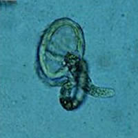 A. lumbricoides larva hatching from an egg