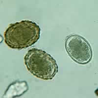 A. lumbricoides eggs, fertile and decorticated