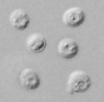C. parvum oocysts, DIC