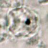 Cyclospora oocyst, trichrome stain