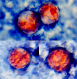 Cyclospora oocysts, modified safranin stain