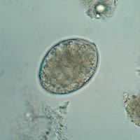 Diphyllobothrium latum egg