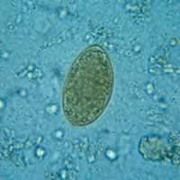 Diphyllobothrium latum egg
