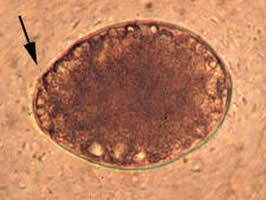 Diphyllobothrium latum egg