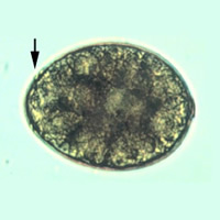 Diphyllobothrium latum egg