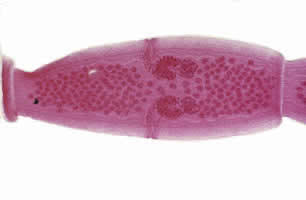 Proglottid of Dipylidium caninum