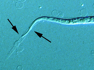 B. malayi tail detail