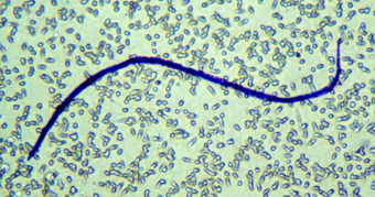W. bancrofti microfilaria on a filter