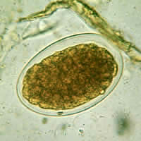 Hookworm egg, advanced cleavage