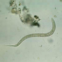 Hookworm rhabditiform larva