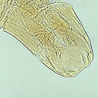 A. duodenale adult, anterior end