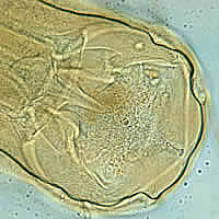 N. americanus adule, anterior end