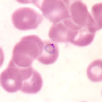 P. falciparum ring - thin smear