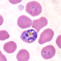 P. falciparum schizonts - thin smear