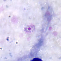 Rings of P. ovale in a thick smear