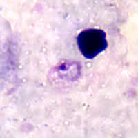 Rings of P. ovale in a thick smear