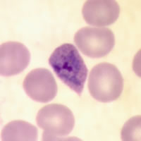 P. ovale trophozoite - thin smear