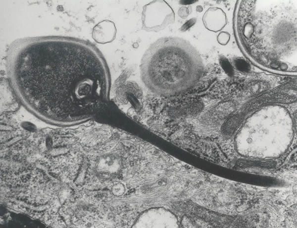 Microsporidian spore with an extruded polar tubule