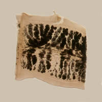 T. solium gravid proglottid