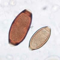 T. trichiura eggs