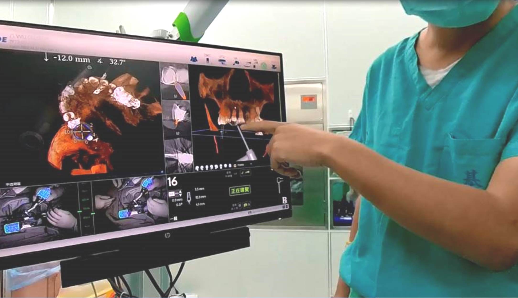 輔助精準植牙技術，嘉基引進3D 藍光導航系統 顎面手術再躍進