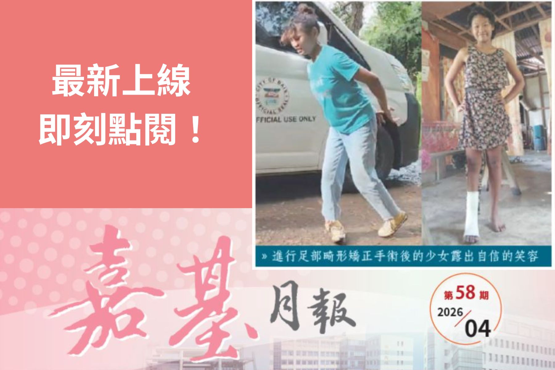 嘉基月報第58期上線囉！一個約定，嘉基短宣團隊再次回到菲律賓拜伊斯市，為足部畸形，生活和求學受到影響的少女進行手術....